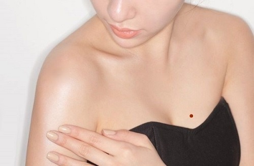 nốt ruồi son ở ngực phụ nữ